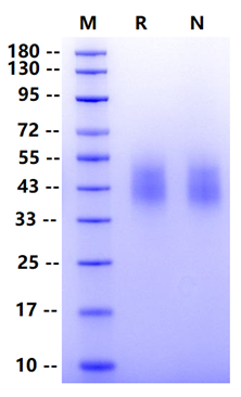 Biotinylated DNAM-1/CD226 His&Avi Tag Protein, Human