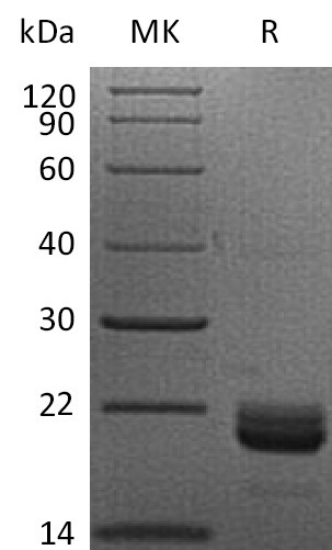 LIGHT/TNFSF14 His Tag Protein, Human