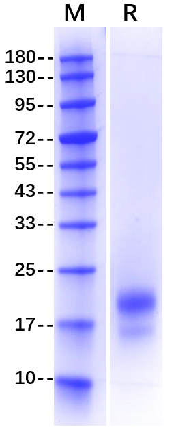 Epididymis Protein 4(HE4) His Tag Protein, Human