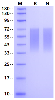 CD300g/Nepmucin/CLM9 His Tag Protein, Human