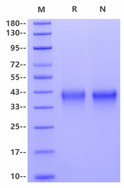 Ephrin-A3 His Tag Protein, Human