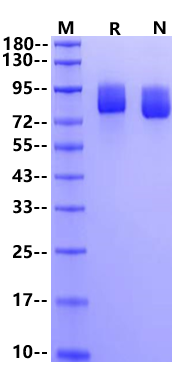 CD117/c-Kit His Tag Protein, Cynomolgus