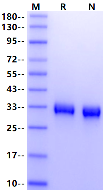 TIMP-1 Protein, Human