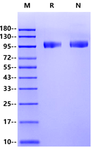 DPP4/CD26 His Tag Protein, Human