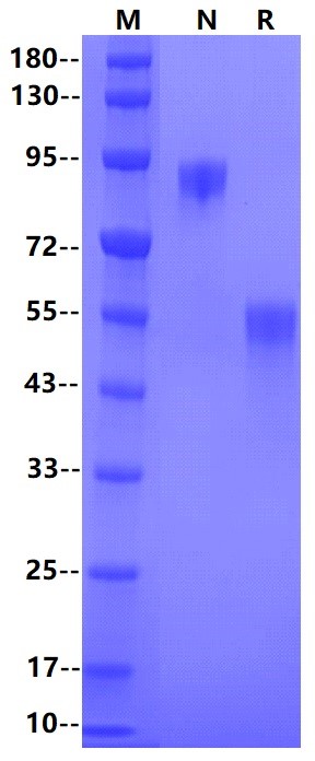 Siglec-8 His Tag Protein, Human