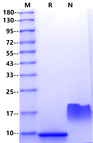 SDF-1α/CXCL12 Protein, Human