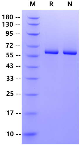 USP14 His Tag Protein, Human