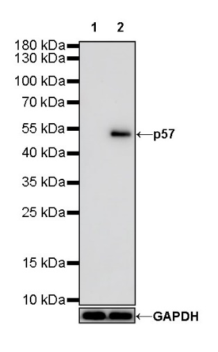 p57 Recombinant Rabbit mAb (SDT-191-79)