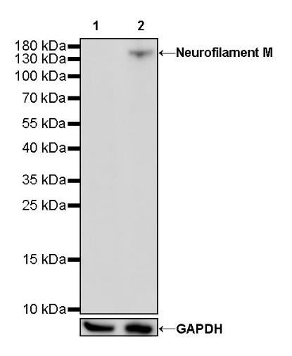 Neurofilament M Recombinant Rabbit mAb (S-501-31)