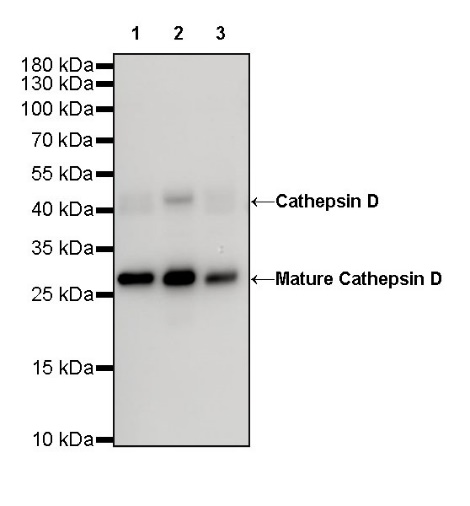 Cathepsin D Recombinant Rabbit mAb (S-R208)