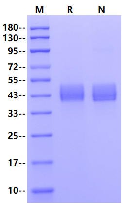 MSLN/Mesothelin (298-600) His Tag Protein, Mouse