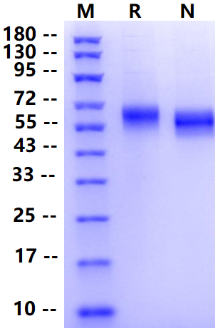 Biotinylated IL-1RAcP/IL-1R3 His&Avi Tag Protein, Human