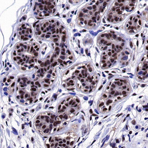 Estrogen Receptor β Recombinant Rabbit mAb (S-1396-67）