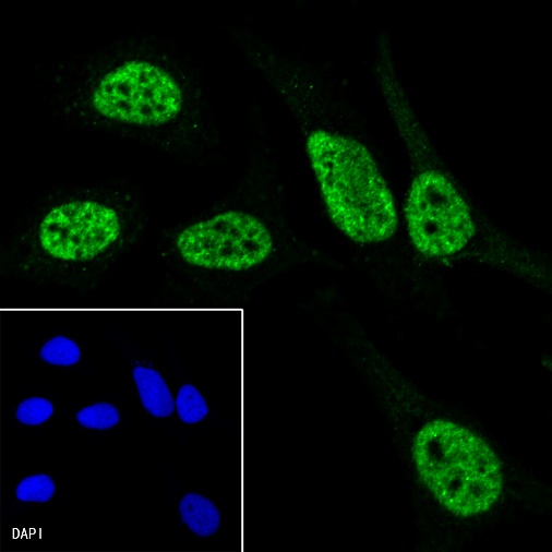 RNA polymerase II CTD repeat YSPTSPS (phospho S7) Recombinant Rat mAb (S-R198)