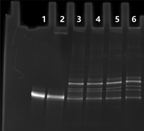 T4 RNA Ligase 1