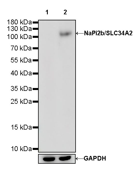 S-RMab® NaPi2b/SLC34A2 Recombinant Rabbit mAb (S-R229)