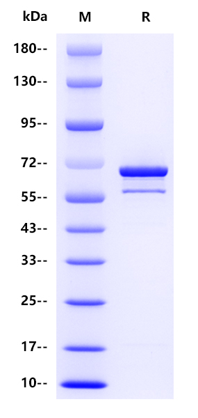 Influenza B virus NP（strain B/Victoria/2/1987）, His tag 