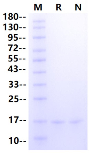 FABP3 His Tag Protein, Human