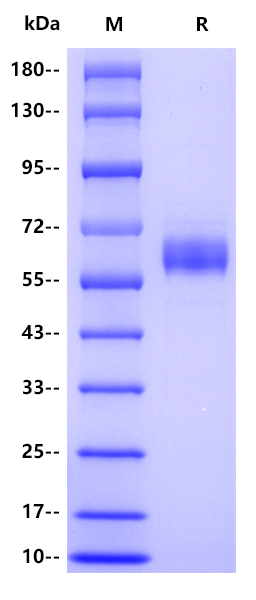 Human Plasminogen, His tag