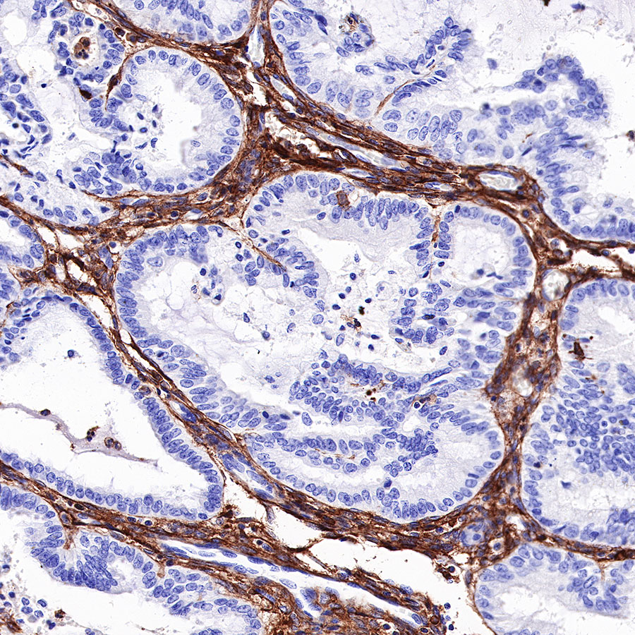CD13 Recombinant Rabbit mAb (SDT-R162)