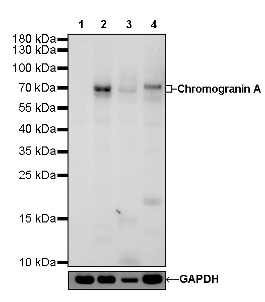 S-RMab® Chromogranin A Recombinant Rabbit mAb (SDT-074-57)