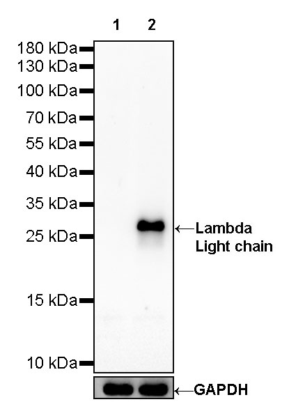 Lambda Light chain Recombinant Rabbit mAb (SDT-326-22)