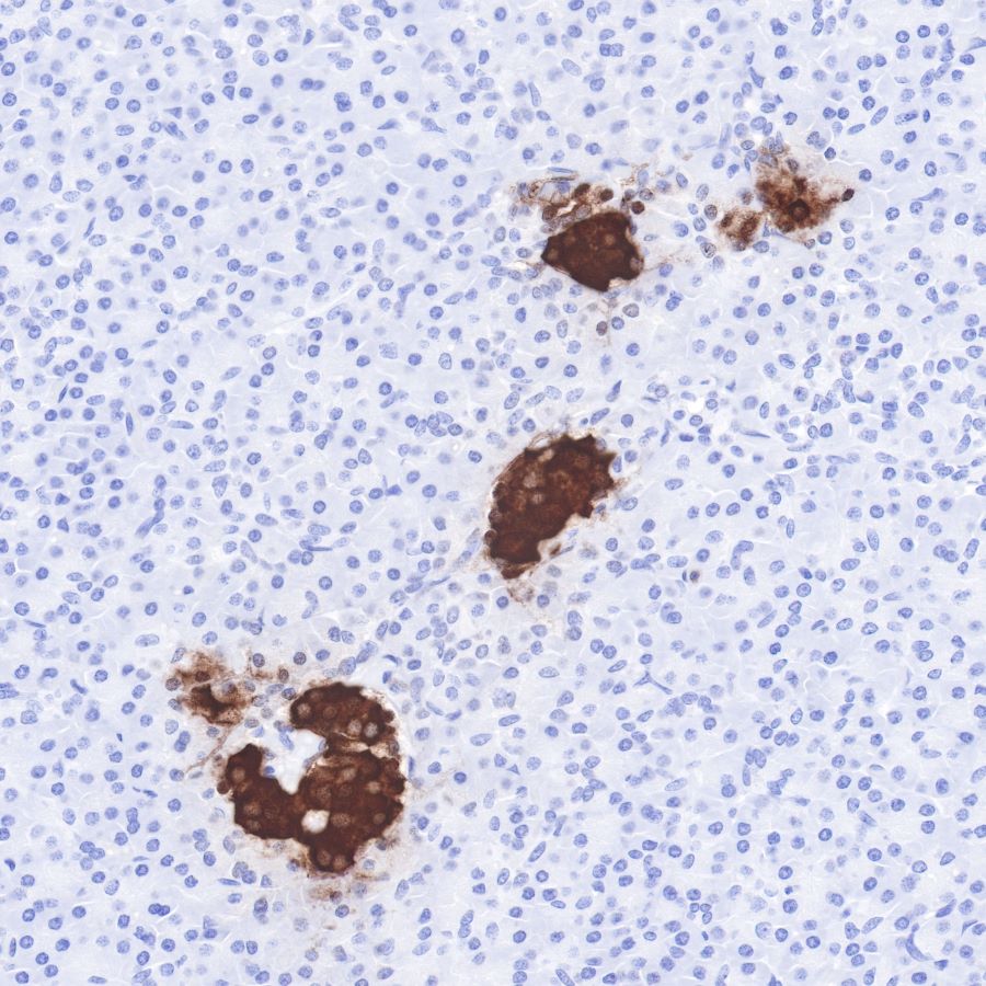 Insulin Recombinant Rabbit mAb (SDT-026-17)