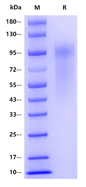 HRSV Glycoprotein G (Strain A2), His tag