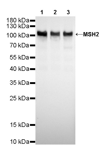 MSH2 Recombinant Rabbit mAb (SDT-037-20)