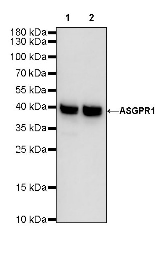 ASGPR1 Recombinant Rabbit mAb (S-R292)