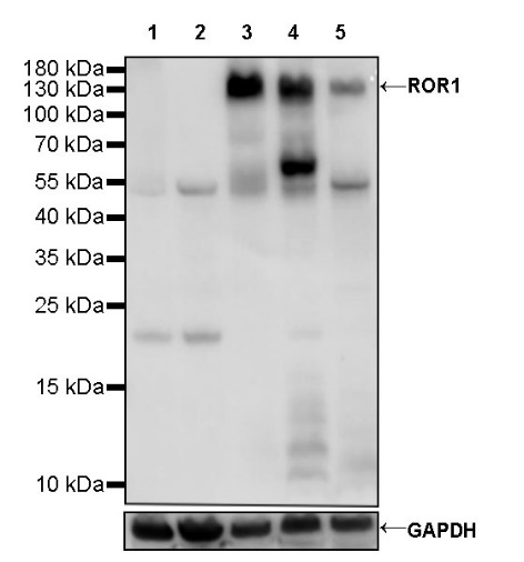 ROR1 Recombinant Rabbit mAb (SDT-R501-147)