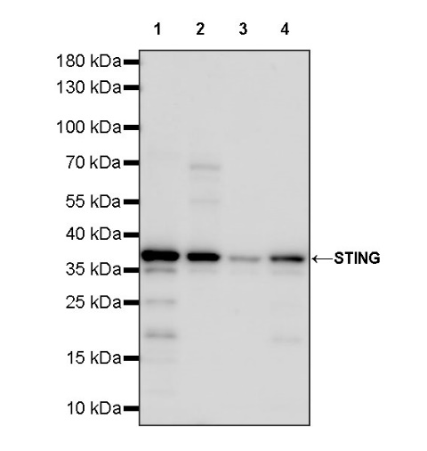 STING Recombinant Rabbit mAb (S-1392-33)