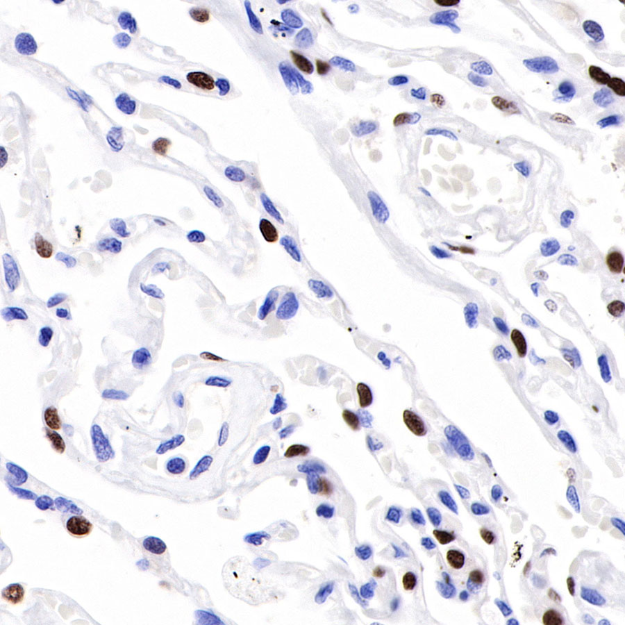 S-RMab® TTF-1 Recombinant Rabbit mAb (SDT-R097)
