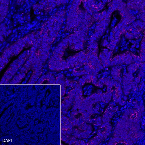 E-Cadherin Recombinant Rabbit mAb (Alexa Fluor® 647 Conjugate) (S-438-5)