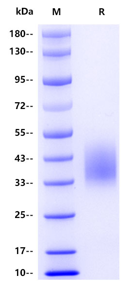 Human CD16b, His tag