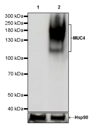 MUC4 Recombinant Rabbit mAb (SDT-841-13)