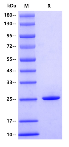Human MG53/TRIM72 Protein, His tag