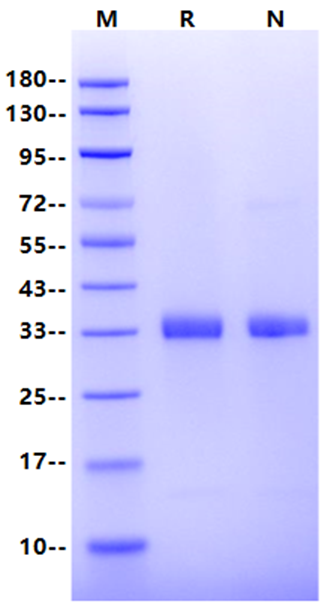 Prolactin R/PRLR His Tag Protein, Human