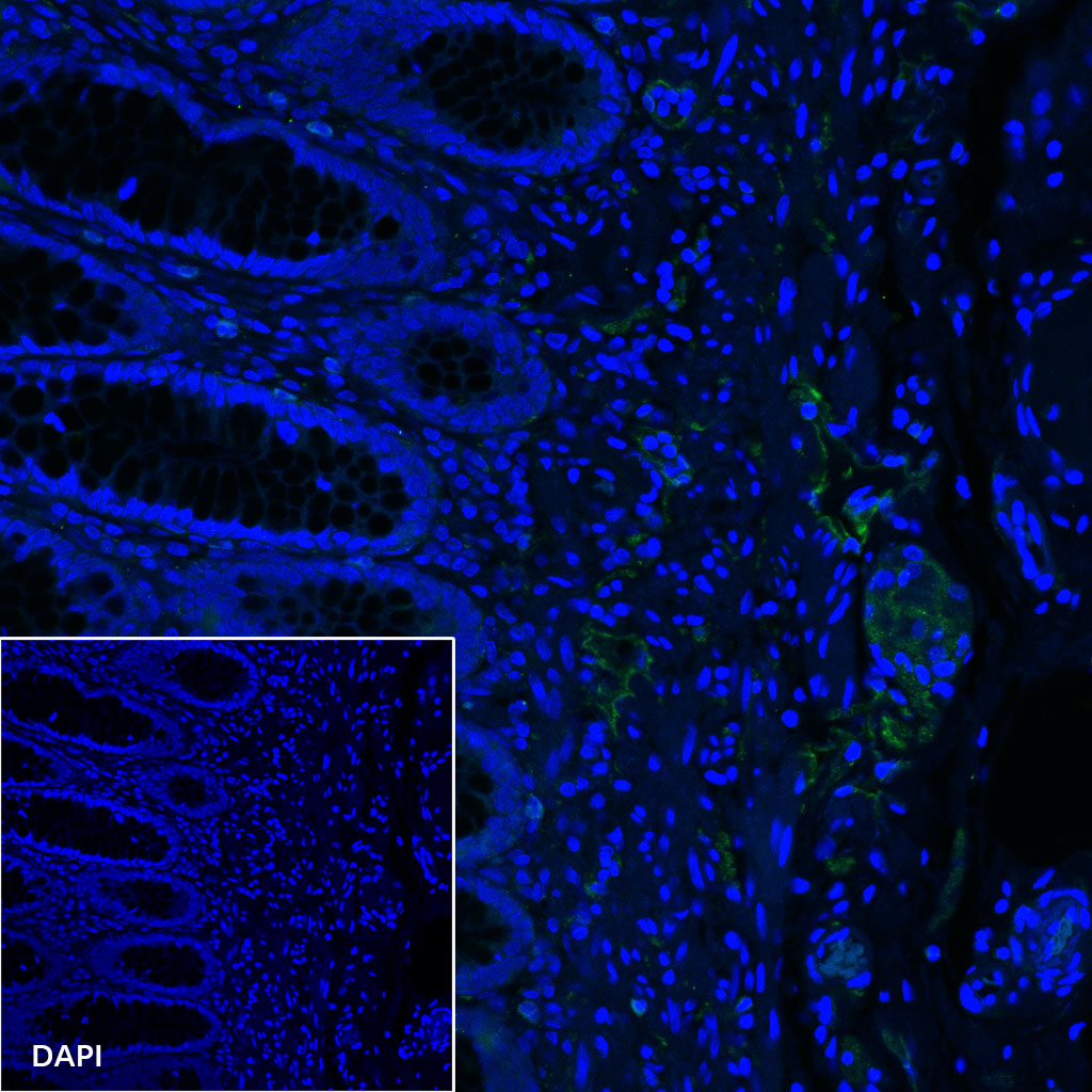 Podoplanin (D2-40) Recombinant Rabbit mAb (SDT-1178-8)