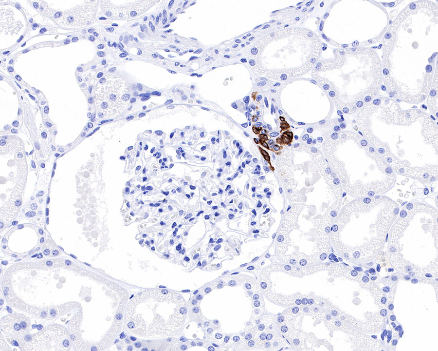 Renin Recombinant Rabbit mAb (SDT-087-48)