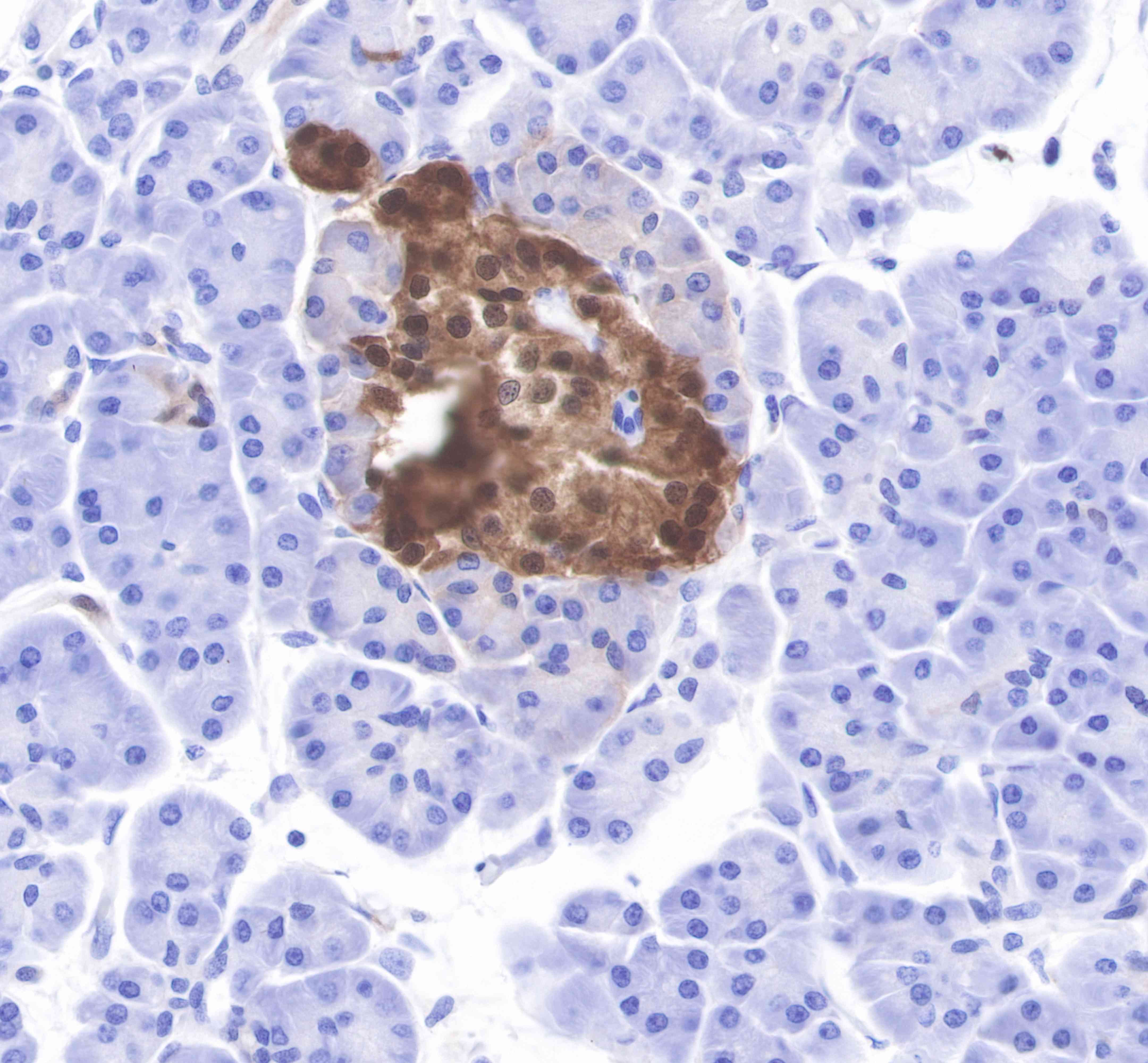 SCGN Recombinant Rabbit mAb(SDT-040-69)