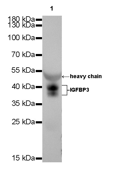 IGFBP3 Recombinant rabbit mAb (SDT-086-63)