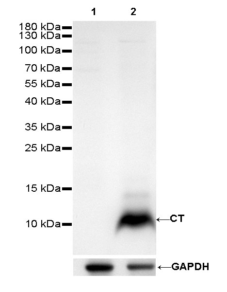 Calcitonin (CT) Recombinant Rabbit mAb (SDT-204-72)