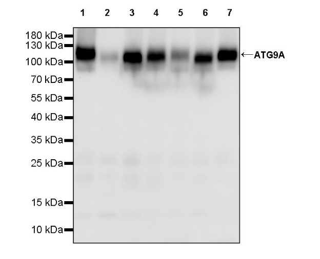 ATG9A Recombinant Rabbit mAb (S-1418-5)