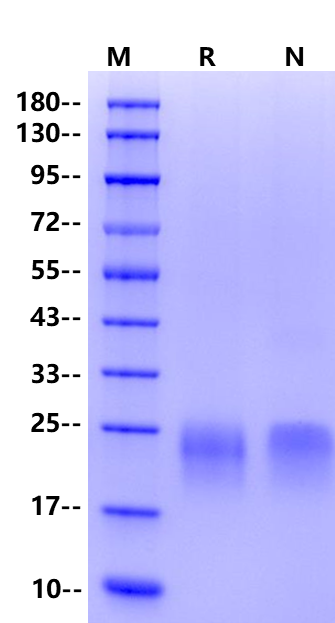 CTLA-4 His Tag Protein, Human