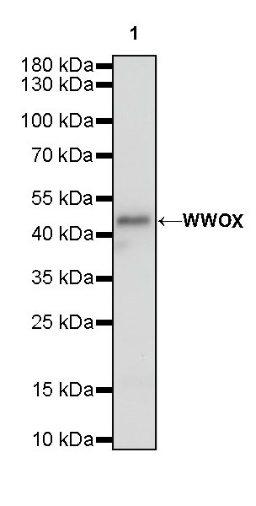 WWOX Recombinant Rabbit mAb (S-R298)