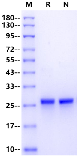 LCN2/NGAL His Tag Protein, Human