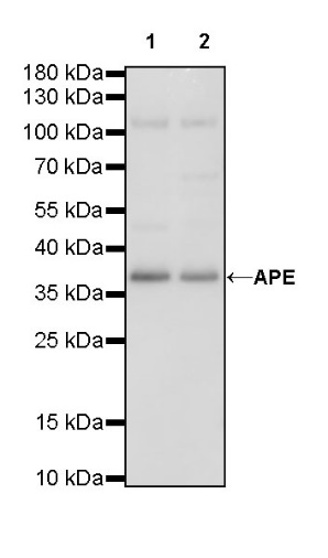 APE Recombinant Rabbit mAb (S-R349)