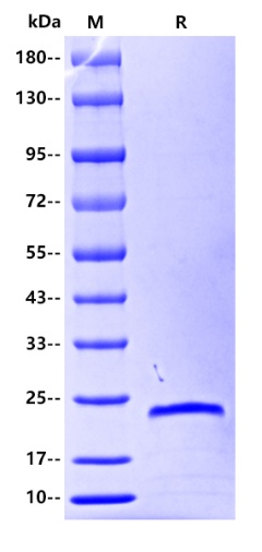 Human IL-28A Protein, His tag