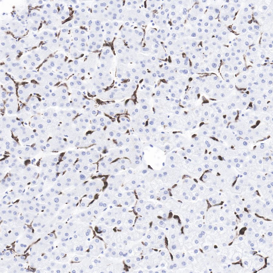 S-RMab®CD68 Recombinant Rabbit mAb (SDT-R025)